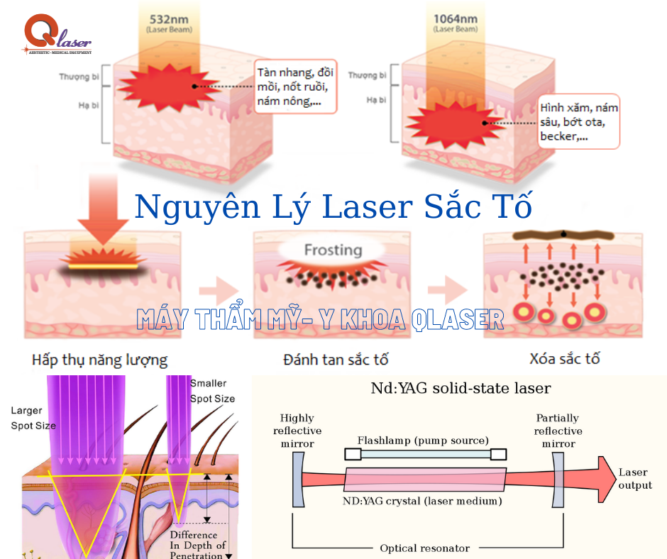 Hình ảnh mô tả quá trình laser tiếp cận mô đích trong điều trị Nám, xóa xăm