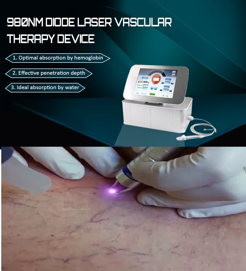 máy laser trị giãn mao mạch, mạch máu đỏ trên mặt